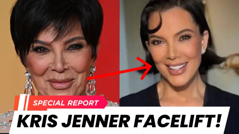 Kris Jenner's Facelift: 5 Shocking Truths She Revealed