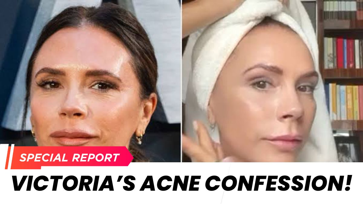 Victoria Beckham Opens Up About Past Acne Struggles